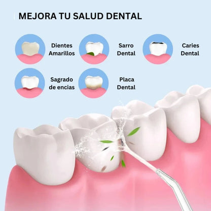 Irrigador Bucal SoftClean